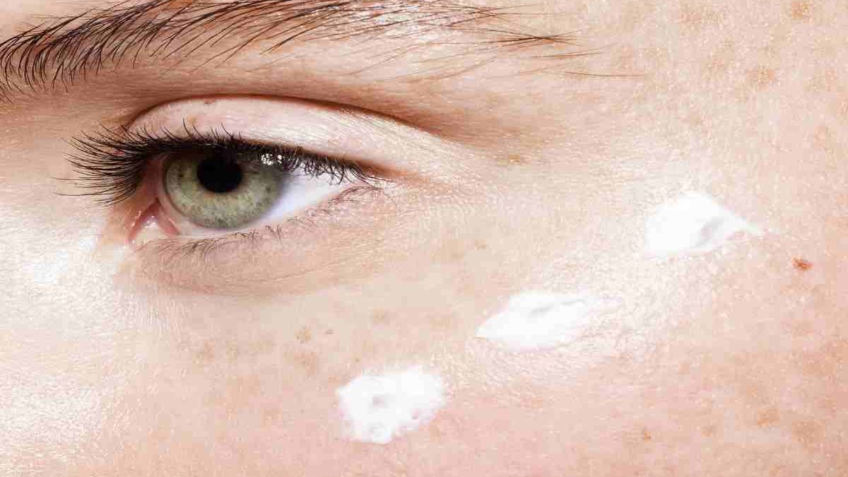 Best Under Eye Cream For Dark Circles